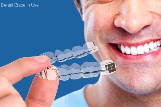 Vision of Stereax M50 powering smart dental brace