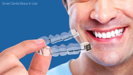 Vision of Stereax M50 powering smart dental brace