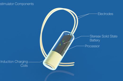 Vision of Stereax M50 powering neurostimulator