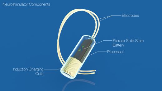 Vision of Stereax M50 powering neurostimulator